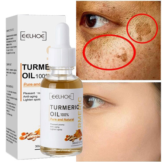 Turmeric Melasma Whitening Correcting Serum Facial Care Essence Oil Dark Spot Removal Brighten Skin Fade Pigment Freckle Melanin