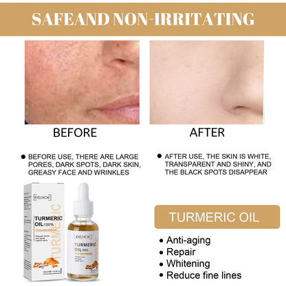 Turmeric Melasma Whitening Correcting Serum Facial Care Essence Oil Dark Spot Removal Brighten Skin Fade Pigment Freckle Melanin