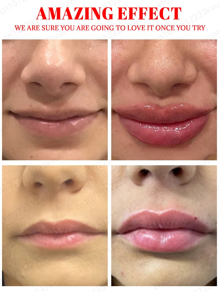 Professional title: "Hydrating Lip Plumping Balm with Long-lasting Effects for Fuller and Youthful-looking Lips"