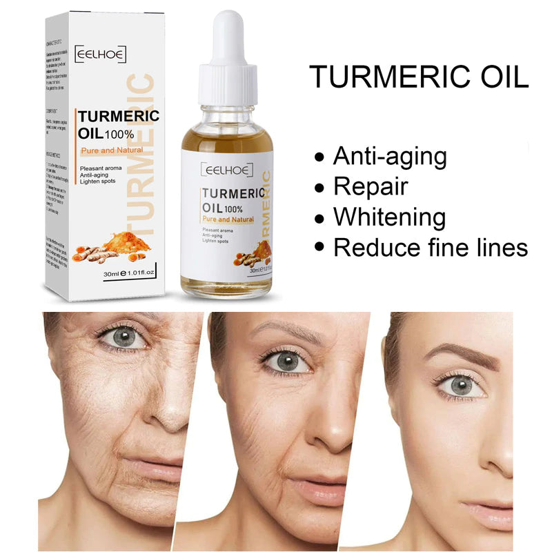 Turmeric Melasma Whitening Correcting Serum Facial Care Essence Oil Dark Spot Removal Brighten Skin Fade Pigment Freckle Melanin